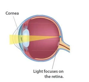 normal eye diagram , emmetropia